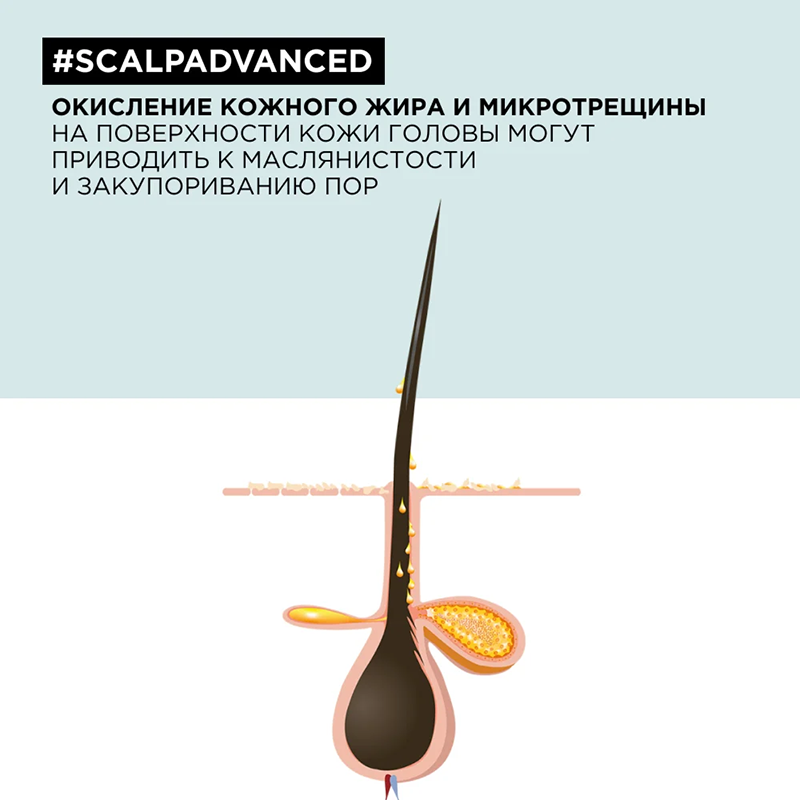 Шампунь-маска очищающий для кожи головы, склонной к жирности / SCALP ADVANCED 250 мл L'OREAL PROFESSIONNEL купить по оптовым и розничным ценам