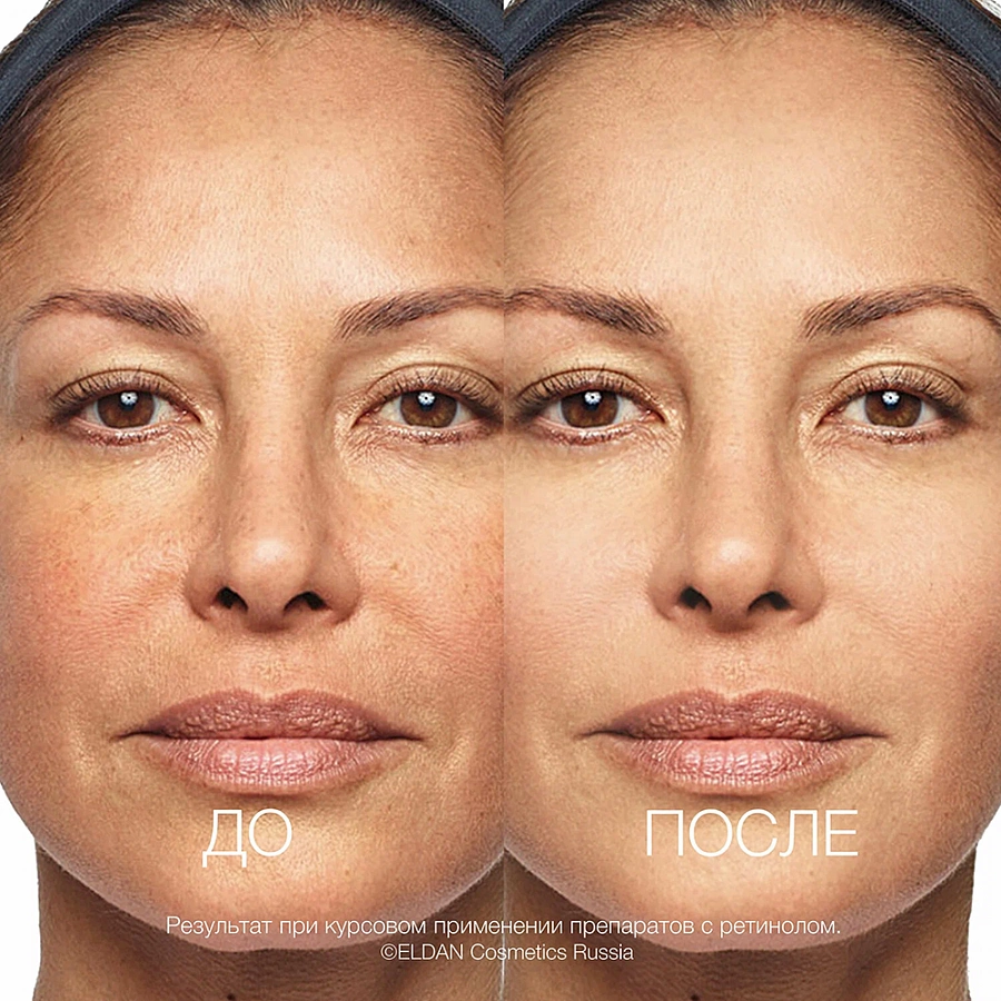 Крем интенсивный anti-age с ретинолом / Extra-intensive anti-aging cream 50 мл ELDAN купить по оптовым и розничным ценам